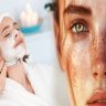 Professional Facial Treatments for Women with Dark Spots